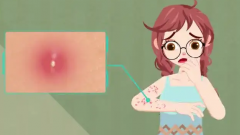 脸上长痘痘的全面调理指南